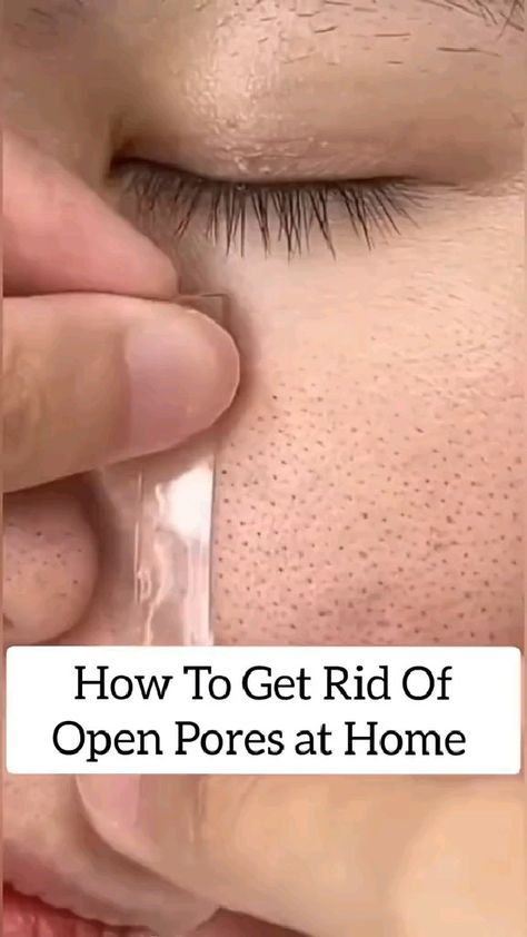 Dry Skin Care, Dry Skin Care Routine, Good Skin Tips, Natural Skin Care Remedies, Beauty Tips For Glowing Skin, Facial Skin Care Routine, Natural Skin Care Routine, Natural Skin Care, Diy Skin Care Routine