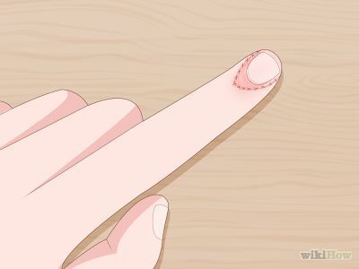 How to Grow Your Nail Beds -- via wikiHow.com Art, Crafts, Glow, Motivation, How To Grow Nails, Grow Nails Faster, Grow Long Nails, Growing Nails, Quick Nail Growth