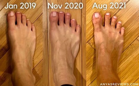 Why Birkenstocks Aren't a Long Term Solution to Foot Pain | Anya's Reviews Fitness, Birkenstock, Yoga, Best Barefoot Shoes, Orthopedic Sandals, Barefoot Shoes, Orthopedic Shoes, Foot Health, Strengthen Feet