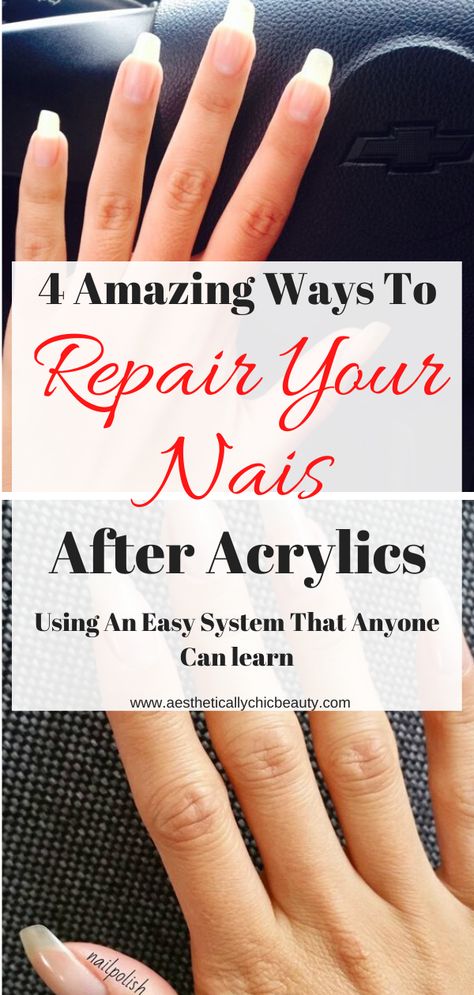 Soak Off Acrylic Nails, Removing Acrylic Nails, Damaged Nails Repair, Remove Acrylics, Split Nail Repair, Nail Strengthener, Nail Growth Remedies, Damaged Nails, Nail Repair