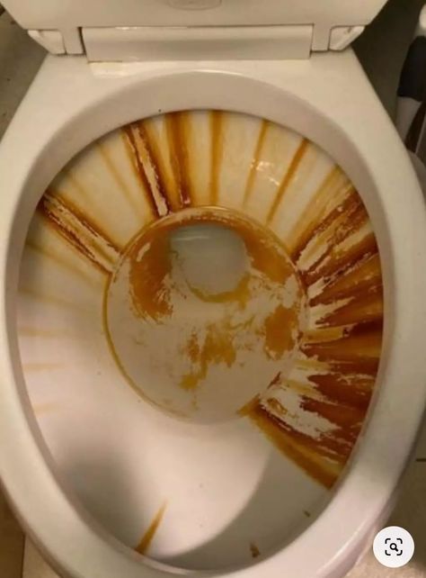 Search Results for “HOW TO REMOVE HARD WATER STAINS IN A TOILET NATURALLY” – 99easyrecipes Stains In Toilet Bowl, Remove Toilet Bowl Stains, Clean Toilet Bowl Stains, Hard Water Toilet Stain Remover, Toilet Hard Water Stains, Stain Removers, Toilet Stains, Clean Toilet Bowl, Remove Rust Stains