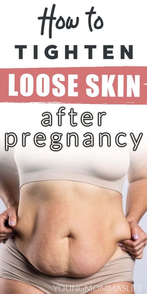 Looking for postpartum tips on how to loose the mommy pooch? Say no more! Learn how to get rid of loose belly skin fast. Tighten loose belly skin after pregnancy, after weight loss or after surgery. We'll also share a skin tightening cream that is 100% natural and safe to use during pregnancy so don't miss out! Fitness, Detox, Tighten Tummy, Postpartum Tummy, Stubborn Belly Fat, Tighten Loose Skin, Loose Belly Fat, Losing Weight Postpartum, Postpartum Stomach