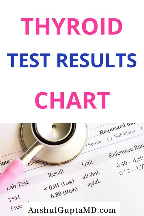 What Thyroid Tests To Ask For? Various Testing for Thyroid Function and antibodies. Optimal Thyroid Test Result Charts #thyroid #hypothyroidism #anshulguptamd Fitness, Thyroid Function Tests, Thyroid Test, Thyroid Hormone, Thyroid Function, Thyroid Test Results, Thyroid Panel, Thyroid Levels, Hypothyroidism