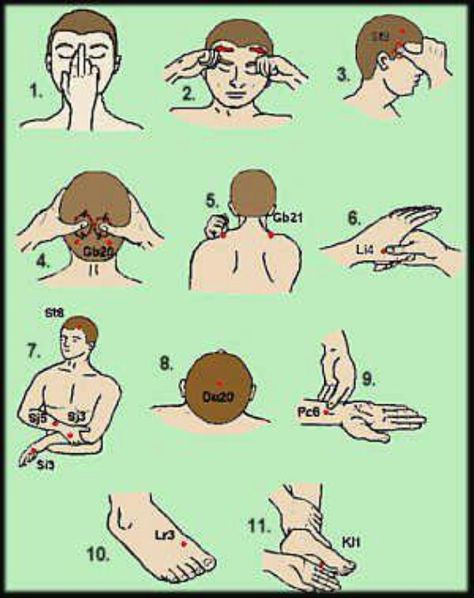 Massage Points for Migraine Relief- how funny, I actually do some of these when I have a migraine, I just didn't know they were massage points. Pressure Points For Headaches, Migraines Remedies, Migraine Relief, Headache Remedies, Acupressure Points, Headache Relief, Migraine Headaches, Posturas De Yoga, Pressure Points