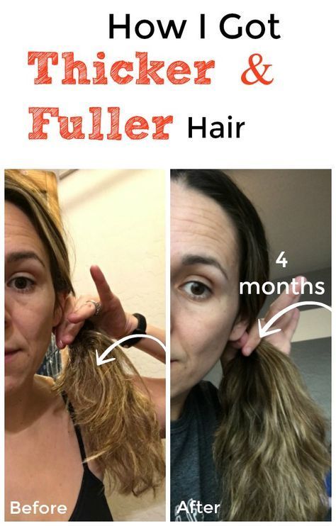 How I Got Thicker, Fuller Hair in 4 Months NATRUALLY! Healthier, stronger hair without buying anything expensive. No funny oils, drugs or medications. Get Thicker Hair, Help Hair Grow, Prevent Hair Loss, Thicker Fuller Hair, Hair Loss Remedies, Thicker Hair Naturally, Hair Regrowth, Hair Loss Shampoo, Natural Hair Loss Treatment