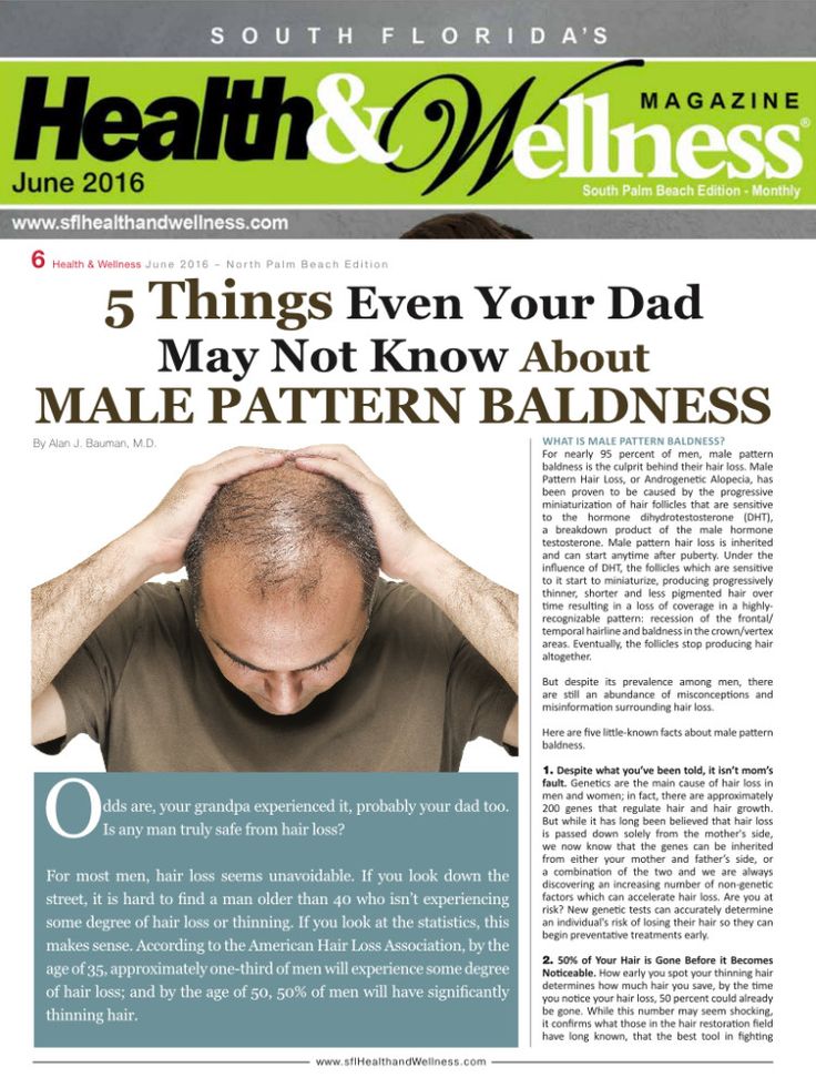 5 Things Even Your Dad Didn’t Know About Male Pattern Baldness Baldness Solutions, Male Pattern Baldness Remedies, Bald Spot Treatment, Male Pattern Baldness, Anti Hair Loss, Male Pattern Hair Loss, Hair Regrowth Treatments, Balding