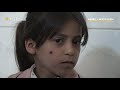 Lack of support leads to hiking leishmaniasis cases in Syria's Manbij – North Press
