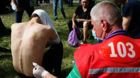 EPA Doctors provide medical treatment to people, who were reportedly tortured and beaten by the police, after being released from a detention center in Minsk, Belarus, 14 August 2020