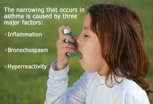 During an asthma attack, airways become inflamed and sensitive.