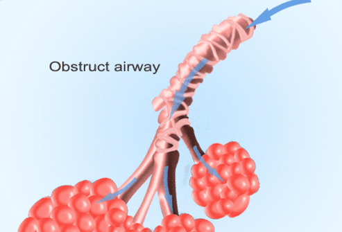 The larger tubes that split off from your trachea and into your lungs are called your bronchial tubes.