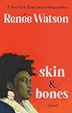 skin & bones: a novel