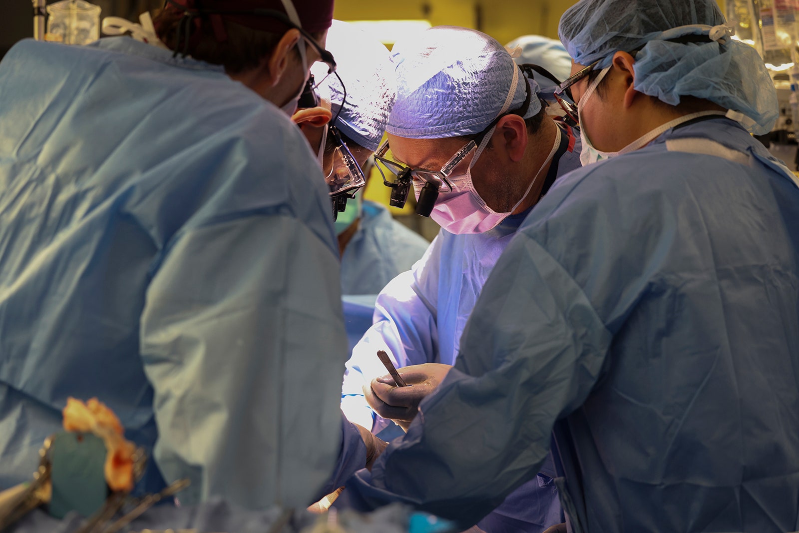 Photo of Surgeons perform the worlds first genetically modified pig kidney transplant into a living human at...