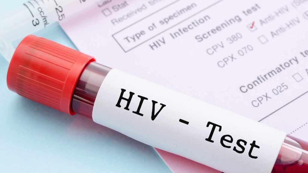 sample blood collection tube with HIV test label on HIV infection screening test form