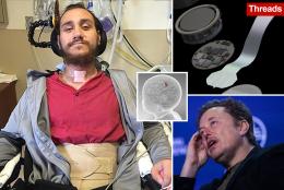Elon Musk’s Neuralink chip suffers unexpected setback in first in-human brain implant