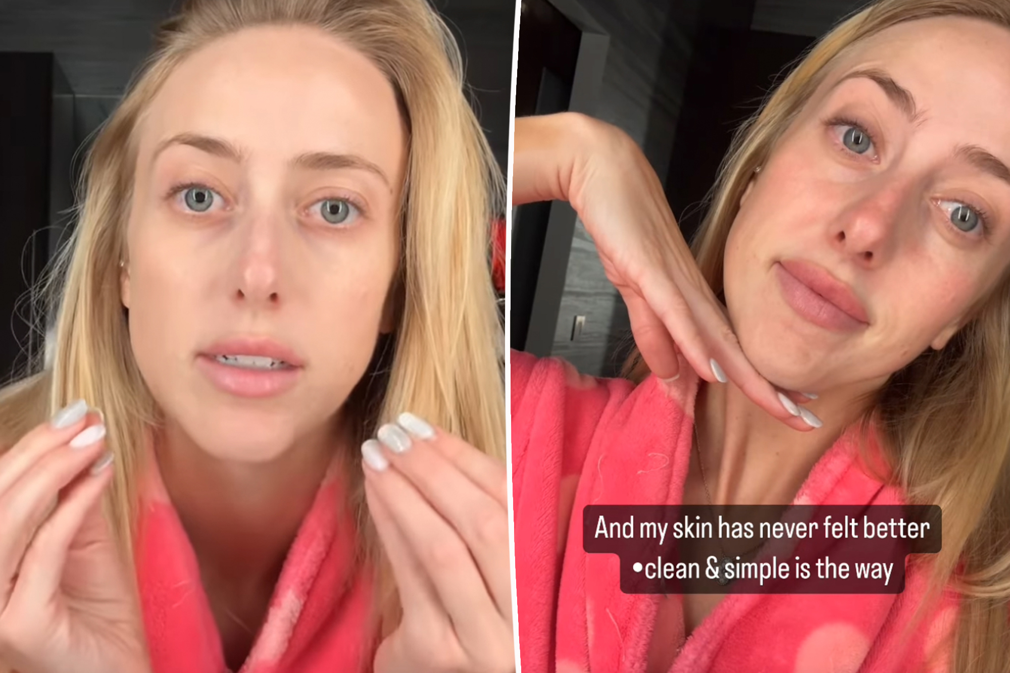 Brittany Mahomes shares her under-$125 skincare routine after revealing she suffers from perioral dermatitis