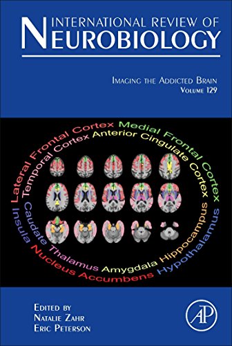 Imaging the Addicted Brain (Volume 129) (International Review of Neurobiology, Volume 129)
                                            