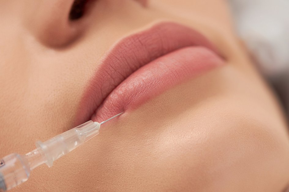 Если вы увеличили губы филлером, ез макияжа придется обходиться минимум 24 часа. Фото: freepik