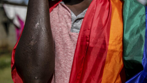 Ugandan gay refugee Martin Okello shows the scars he suffered in an attack in May, outside the house he shares with other LGBT refugees in Nairobi, Kenya, in this photo taken June 11, 2020.