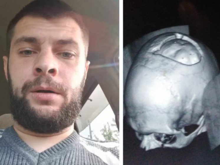  В Новосибирске доброволец с пробитым на СВО черепом записал видеообращение к Андрею Травникову