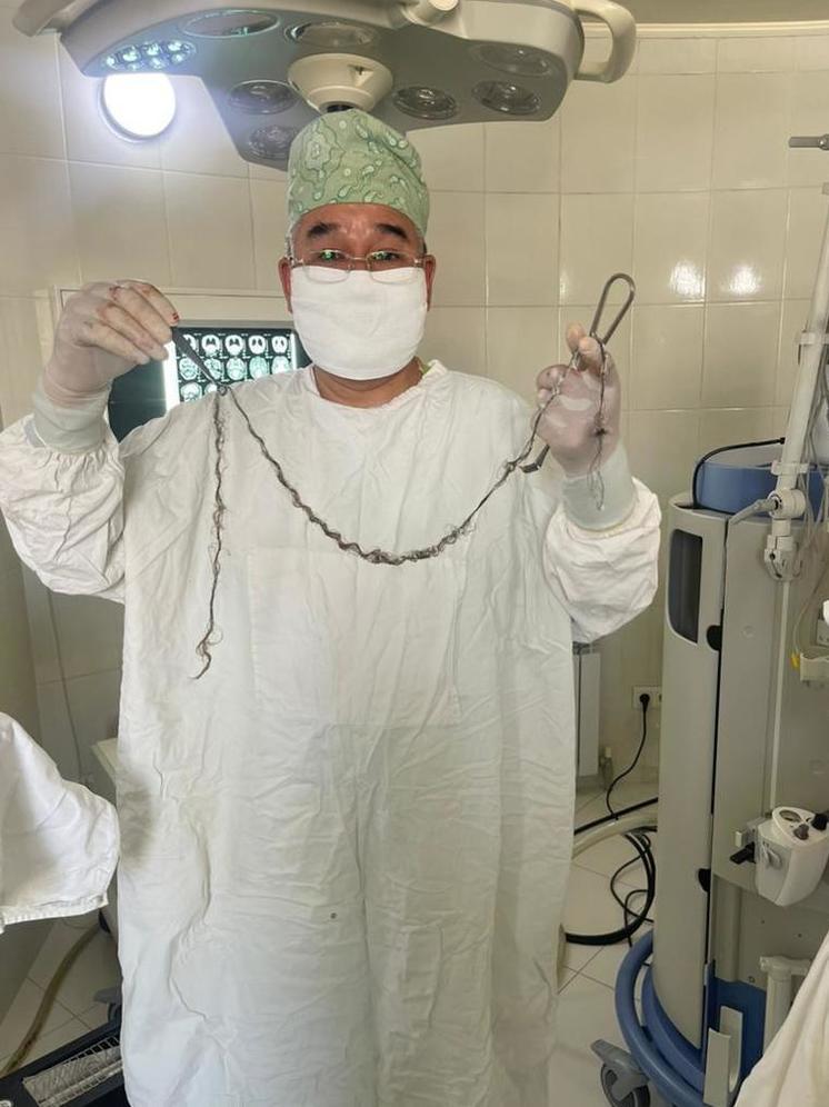 Уникальная операция в Бишкеке: нейрохирурги удалили опухоль с растущими волосами из мозга ребенка